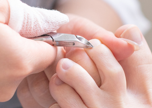 甘皮ケアの写真